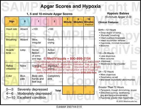 printable apgar score chart