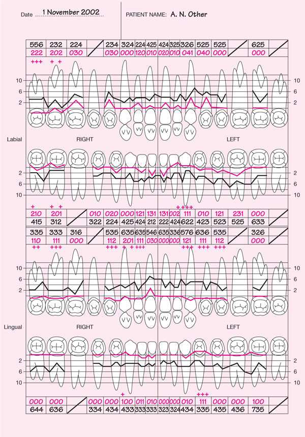 printable periodontal probing chart printable periodontal probing chart