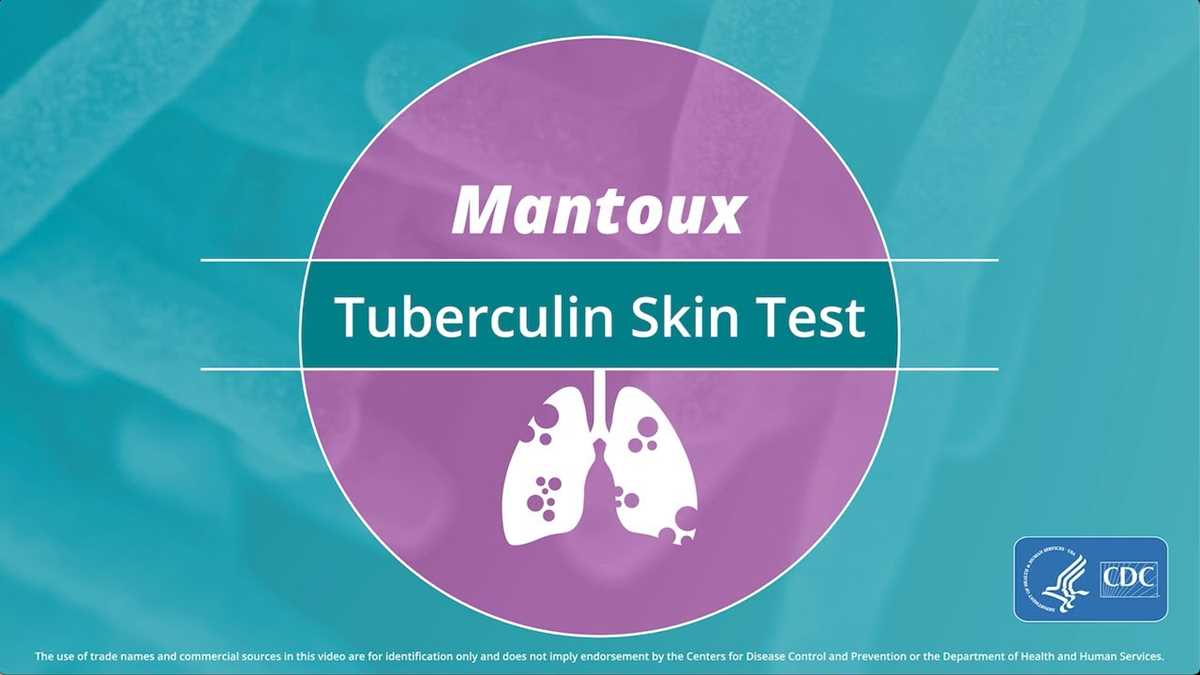 printable 2 step tb skin test form