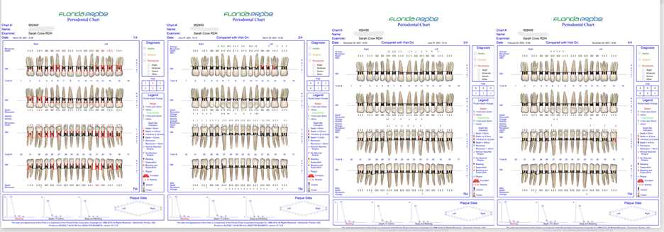 printable periodontal probing chart printable periodontal probing chart