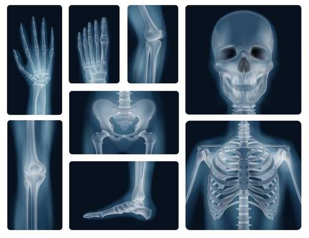 printable x rays